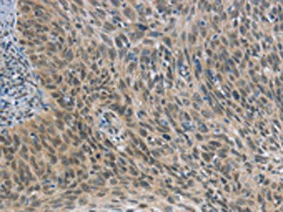 FOXF1 Antibody