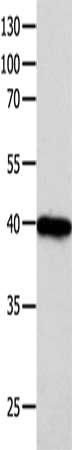 FOXL1 Antibody
