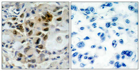 FOXO4 Antibody