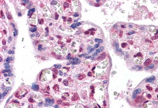 FOXP2 (internal) Antibody