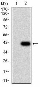 FOXP2 Antibody