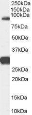 FOXP2 (internal) Antibody