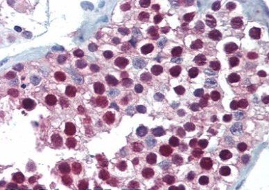 FOXP2 (C terminus) Antibody