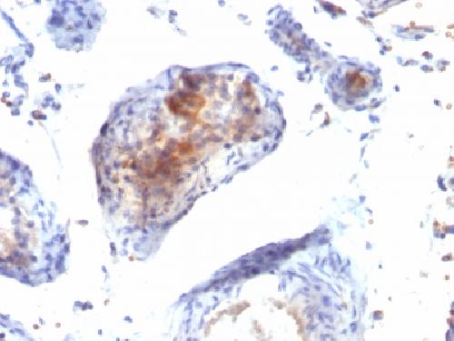 PAX2 Antibody