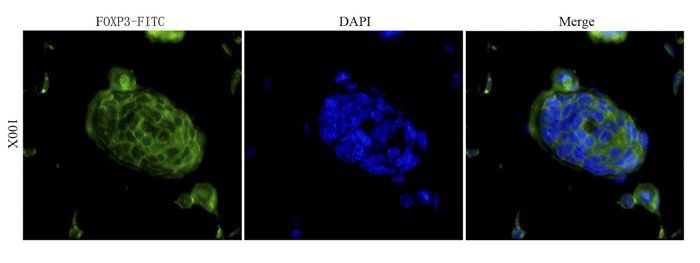 FOXP3 Rabbit Polyclonal Antibody (FITC)