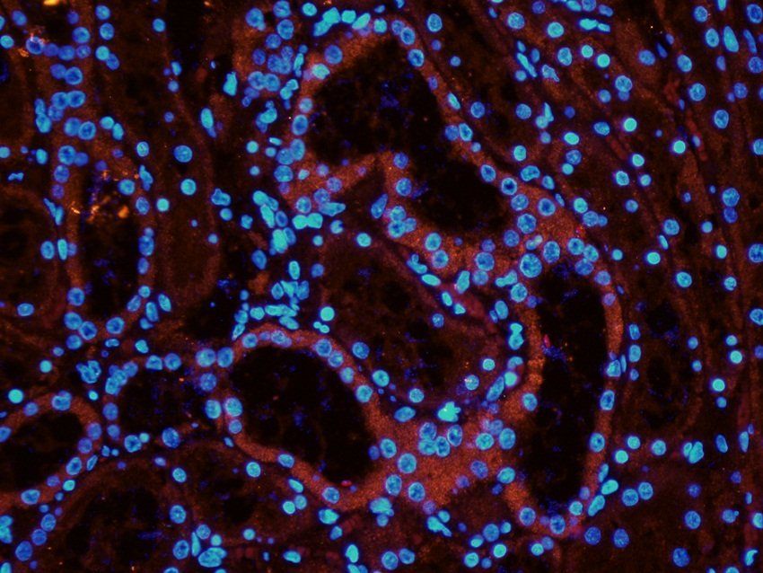 FPR1 Rabbit Polyclonal Antibody