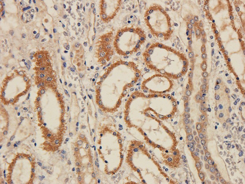 FPR1 Rabbit Polyclonal Antibody