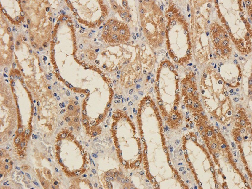 FPR1 Rabbit Polyclonal Antibody