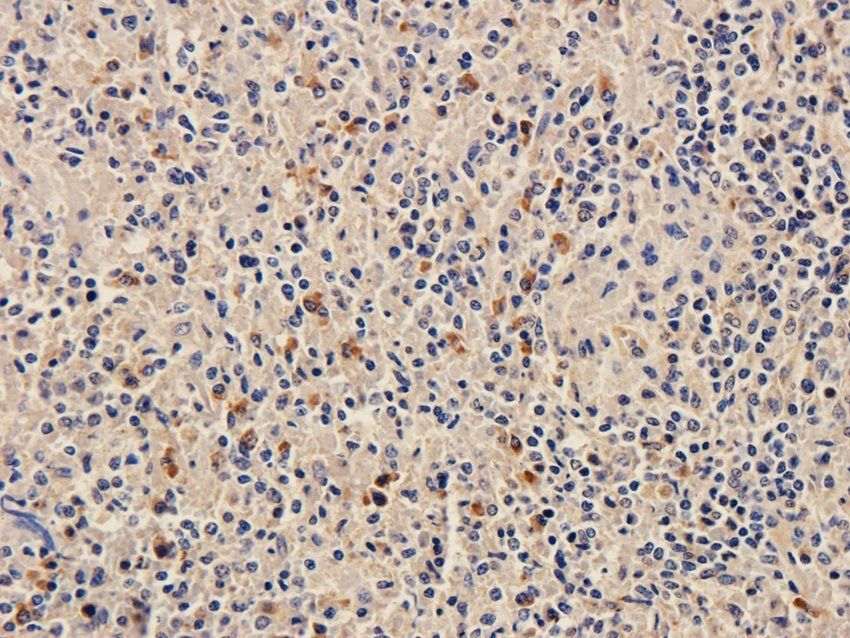 FPR1 Rabbit Polyclonal Antibody