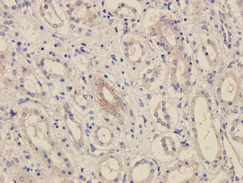 FPR1 Rabbit Polyclonal Antibody
