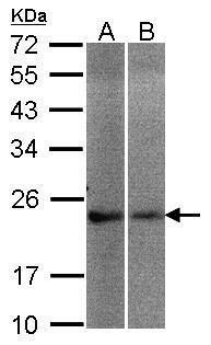 NCS1 Rabbit Polyclonal Antibody