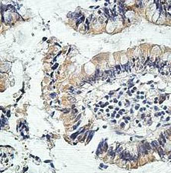 FRMD6 Rabbit Polyclonal Antibody