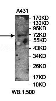 FRMD6 Rabbit Polyclonal Antibody