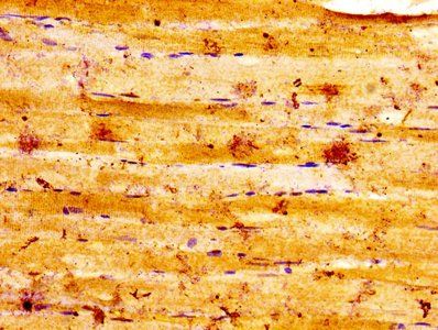 ALDOA Antibody