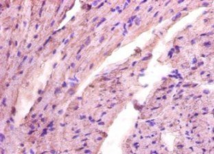 ALDOA Antibody