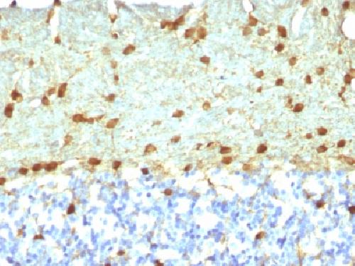 FSCN1 Antibody