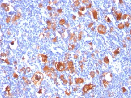 FSCN1 Antibody