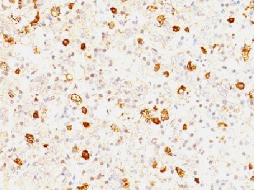 FSHB Antibody