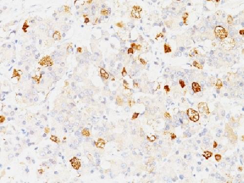 FSHB Antibody