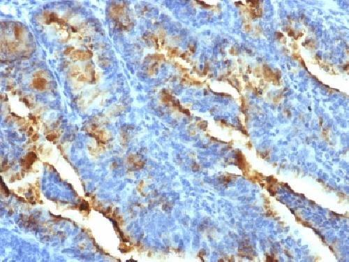 FSHR Antibody