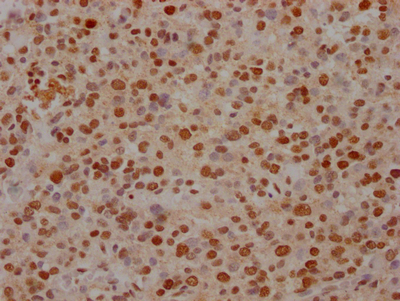 FUBP1 Antibody