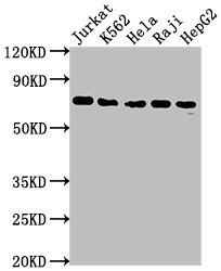 FUBP1 Antibody