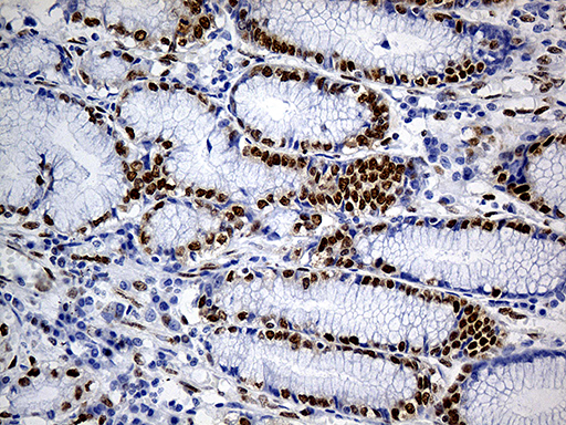 FUBP3 Antibody