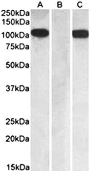 FURIN/PCSK3 Antibody