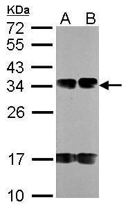 SDHB antibody [C2C3], C-term