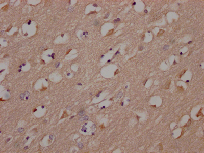 FYN Antibody