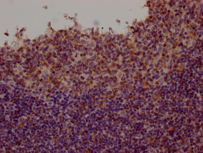FYN Antibody