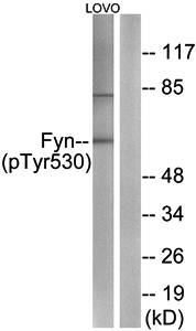 Fyn (Phospho-Tyr530) Antibody