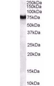FZD8/frizzled 8 Antibody