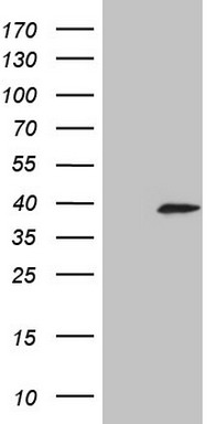 G CSF Antibody