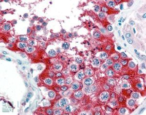 G6PD (aa 308 - 320) Antibody