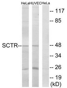 SCTR Antibody