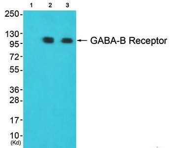 GABA-B Receptor Antibody