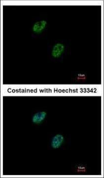 GABPB1 antibody [N1C3]