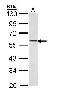 GABPB1 antibody [N1C3]