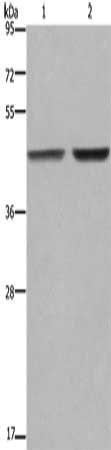 GABPB2 Antibody