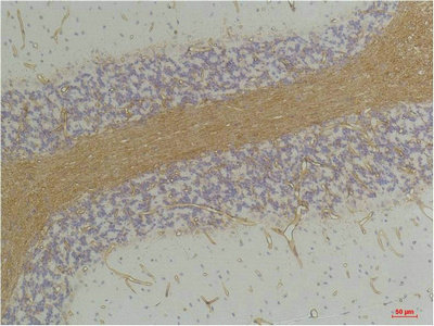 GABRA2 Antibody