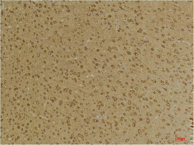 GABRG2 Antibody