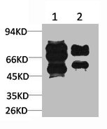 GABRG2 Antibody