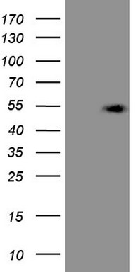 Galectin 3 Antibody