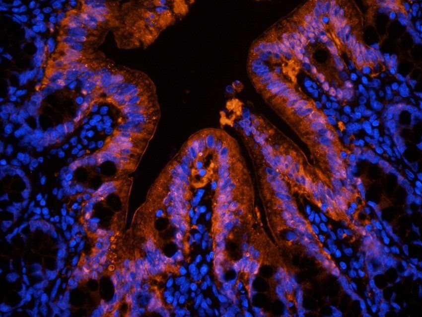 Galectin 3 Rabbit Polyclonal Antibody