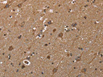 GALK1 Antibody