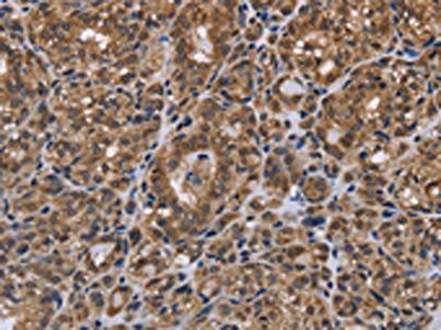 GALK1 Antibody