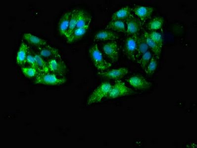 GALK1 Antibody