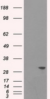 gamma Catenin Antibody