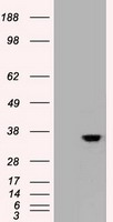 gamma Catenin Antibody